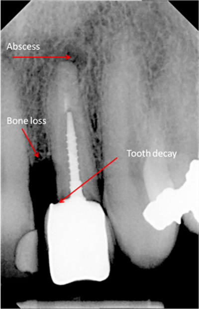 digital x-rays